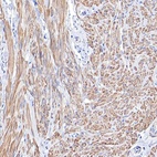 Anti-TPM1 Antibody