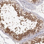 Anti-TBC1D9 Antibody