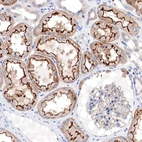 Immunohistochemical staining of human kidney shows strong membranous positivity in cells in tubules.
