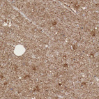 Immunohistochemical staining of human cerebral cortex shows moderate cytoplasmic positivity in neuropil.