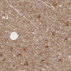 Immunohistochemical staining of human cerebral cortex shows moderate cytoplasmic positivity in neuropil.