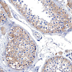 Immunohistochemical staining of human testis shows moderate membranous and cytoplasmic positivity in cells in seminiferous ducts.