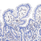 Immunohistochemical staining of human duodenum shows no positivity in glandular cells as expected.