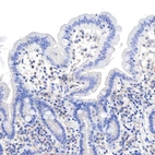 Immunohistochemical staining of human duodenum shows no positivity in glandular cells as expected.