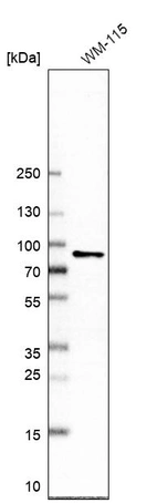 Western blot analysis in human cell line WM-115.
