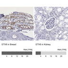 Anti-ETV6 Antibody