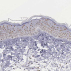 Anti-ETV6 Antibody