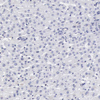 Immunohistochemical staining of human liver shows no positivity in hepatocytes as expected.