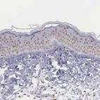 Immunohistochemical staining of human skin shows weak nuclear positivity in keratinocytes.