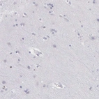 Immunohistochemical staining of human cerebral cortex shows no positivity in neuronal cells as expected.