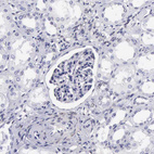 Immunohistochemical staining of human kidney shows no positivity in cells in tubules as expected.