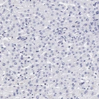 Immunohistochemical staining of human liver shows no positivity in hepatocytes as expected.