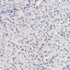 Immunohistochemical staining of human liver shows low expression as expected.