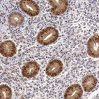 Immunohistochemical staining of human endometrium shows high expression.
