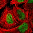 Immunofluorescent staining of human cell line A-431 shows localization to nucleoplasm.