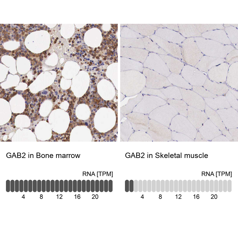 Anti-GAB2 Antibody