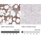 Anti-GAB2 Antibody
