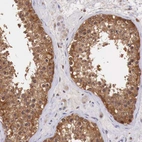 Immunohistochemical staining of human testis shows strong cytoplasmic and membranous positivity in cells in seminiferous ducts.