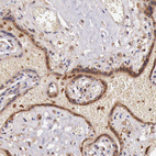 Anti-GAB2 Antibody