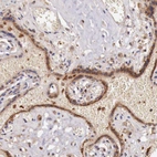 Immunohistochemical staining of human placenta shows moderate cytoplasmic positivity in trophoblastic cells.
