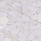 Immunohistochemical staining of human skeletal muscle shows no cytoplasmic positivity in myocytes as expected.