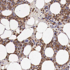 Immunohistochemical staining of human bone marrow shows moderate cytoplasmic positivity in hematopoietic cells.