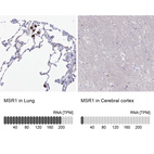 Anti-MSR1 Antibody