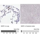 Anti-MSR1 Antibody