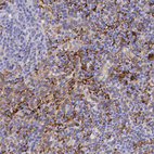 Immunohistochemical staining of human spleen shows moderate cytoplasmic positivity in cells in red pulp.