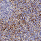 Anti-MSR1 Antibody