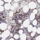 Immunohistochemical staining of human bone marrow shows strong cytoplasmic positivity in hematopoietic cells.