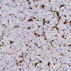 Immunohistochemical staining of human liver shows strong cytoplasmic positivity in Kupffer cells.