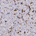 Immunohistochemical staining of human liver shows strong cytoplasmic positivity in Kupffer cells.