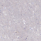Immunohistochemical staining of human cerebral cortex shows no positivity in neurons as expected.