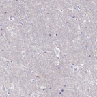 Anti-MSR1 Antibody