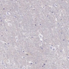 Immunohistochemical staining of human cerebral cortex shows no positivity in neurons as expected.