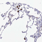 Anti-MSR1 Antibody