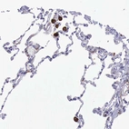 Immunohistochemical staining of human lung shows strong cytoplasmic positivity in macrophages.