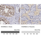 Anti-KHDRBS3 Antibody