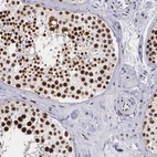Immunohistochemical staining of human testis shows strong nuclear positivity in cells in seminiferous ducts.