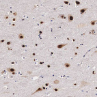 Immunohistochemical staining of human cerebral cortex shows strong nuclear positivity in neurons.