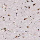 Anti-KHDRBS3 Antibody