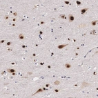 Immunohistochemical staining of human cerebral cortex shows strong nuclear positivity in neurons.
