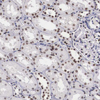 Anti-KHDRBS3 Antibody