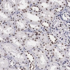 Immunohistochemical staining of human kidney shows moderate to strong nuclear positivity in cells in tubules.
