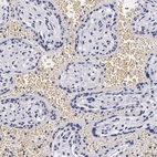 Immunohistochemical staining of human placenta shows no positivity in trophoblastic cells as expected.