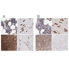 Immunohistochemical staining of human bone marrow, cerebral cortex, cervix, uterine and skeletal muscle using Anti-CKAP4 antibody HPA000278 (A) shows similar protein distribution across tissues to independent antibody HPA000792 (B).