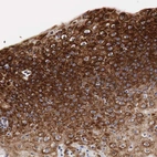 Immunohistochemical staining of human cervix, uterine shows high expression.