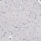 Immunohistochemical staining of human skeletal muscle shows low expression as expected.