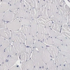 Immunohistochemical staining of human skeletal muscle shows low expression as expected.